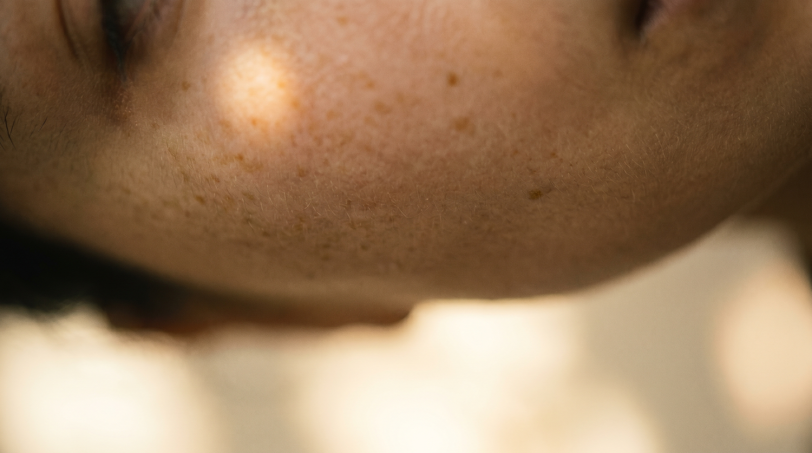 Pigmentation Correction